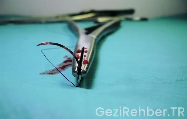 Vize davet mektubu nedir?